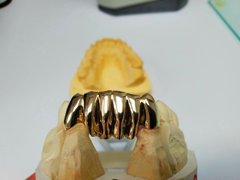 Customized Dental Prosthetics